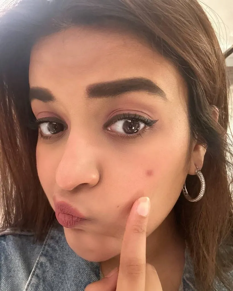 Nidhhi Agerwalpimple